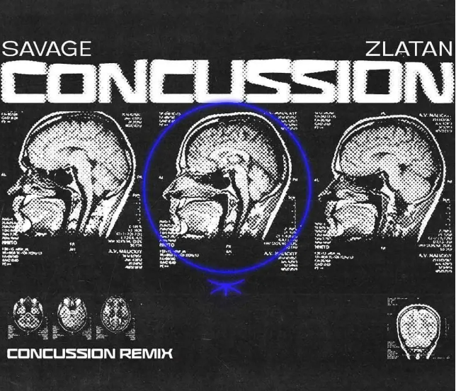 Savage – Concussion (Remix) Ft. Zlatan